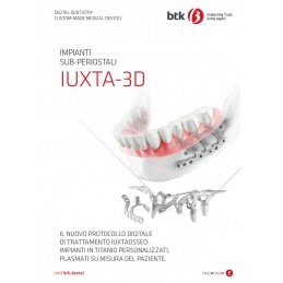 Scarica la Brochure